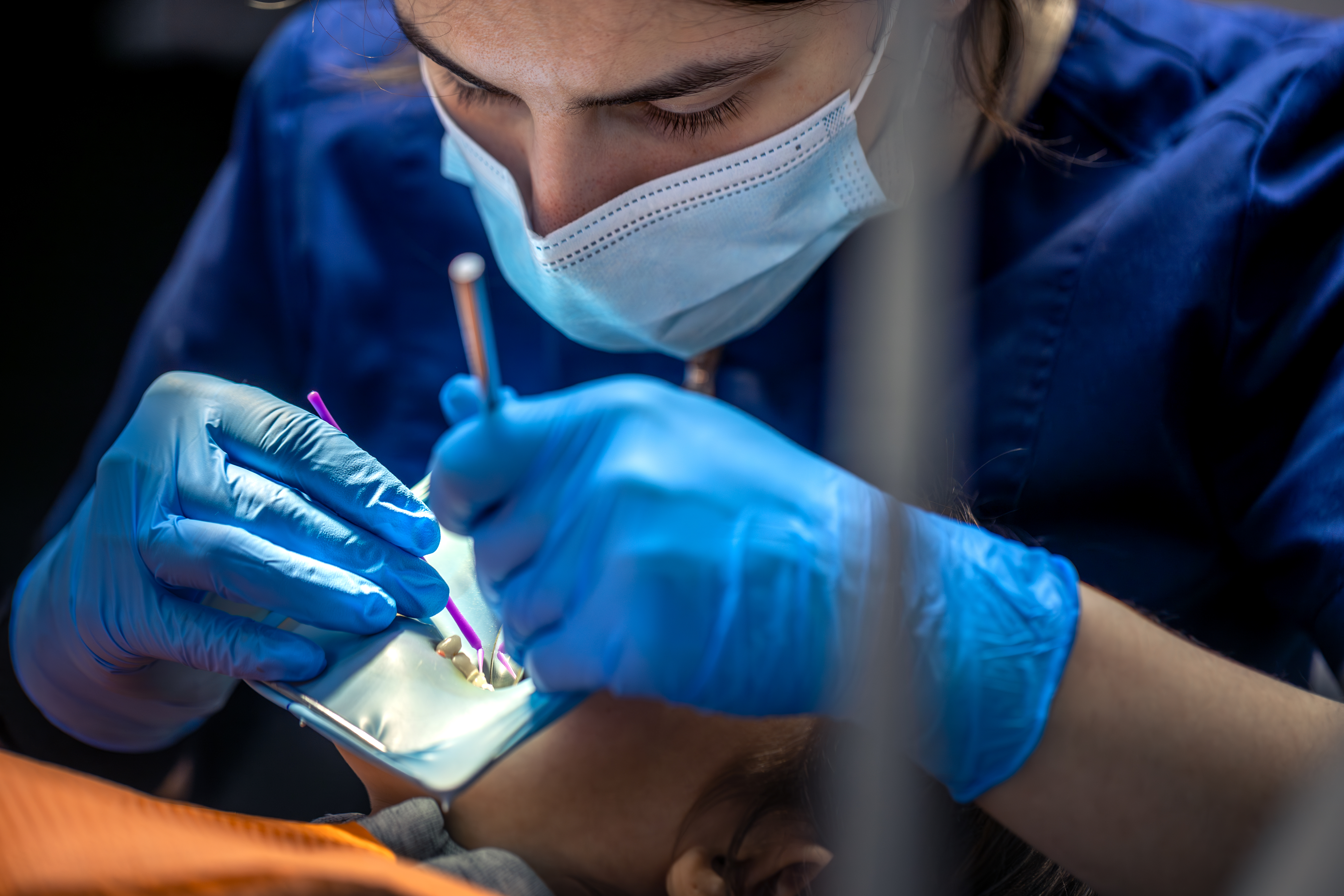 Varicose veins laser treatment